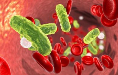 septicemia-symptoms-complications-and-treatment