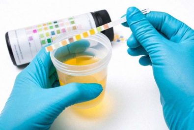 according-to-researchers-a-new-prostate-cancer-test-with-near-100-accuracy-can-be-analyzed-from-urine-in-just-20-minutes
