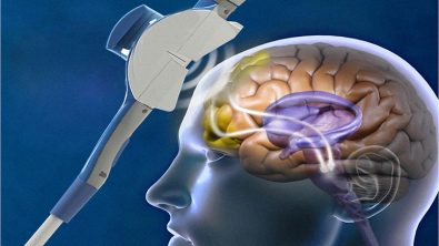 studies-show-how-memory-could-improve-through-magnetic-brain-stimulation