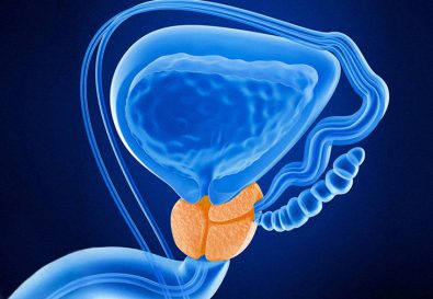 a-protein-that-halts-the-growth-of-tumor-and-is-a-remedy-for-drug-resistance-may-be-the-answer-for-prostate-cancer