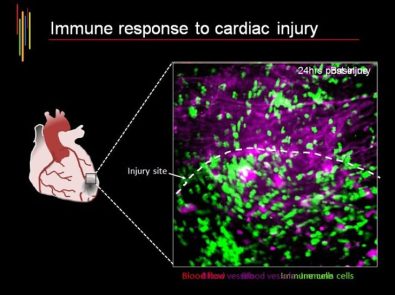 a-brand-new-kind-of-heart-cell-recently-discovered-by-scientists