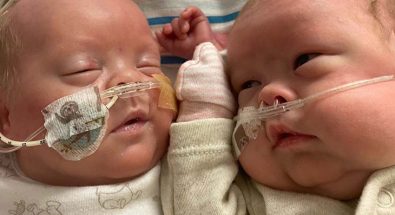 after-given-0-chance-of-survival-uks-most-premature-twins-finally-go-home-after-5-months