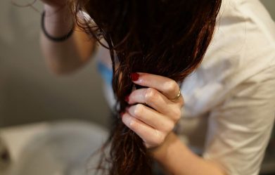 here-are-5-diy-tricks-to-help-deal-with-scalp-psoriasis-irritation