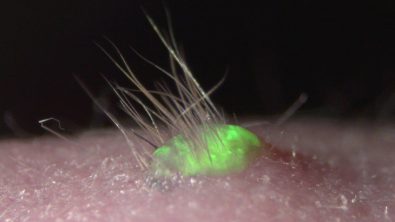 hair-cells-grown-in-a-lab-may-finally-be-able-to-cure-baldness