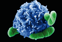 the-new-car-t-cell-therapy-the-answer-for-lupus-patients