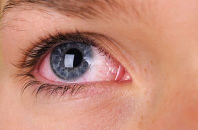 15-things-your-eyes-are-trying-to-tell-you-about-your-overall-health
