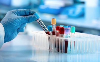 a-new-blood-test-for-ovarian-cancer-may-soon-be-made-available