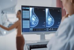 us-panel-recommends-breast-cancer-screenings-to-be-done-at-age-40