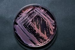 bacteria-dark-matter-the-new-source-of-a-potent-antibiotic