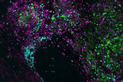 researchers-from-salk-institute-discover-immunotherapy-helps-the-bodys-invisible-scalpel-to-remove-brain-cancer
