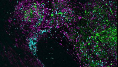 researchers-from-salk-institute-discover-immunotherapy-helps-the-bodys-invisible-scalpel-to-remove-brain-cancer