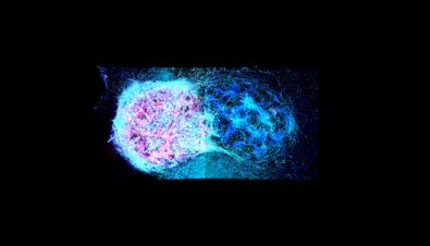 new-study-shows-they-can-3d-print-stem-cells-to-implant-as-functional-brain-tissue