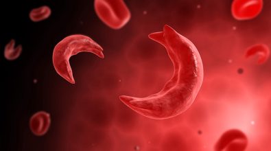 all-about-the-2-gene-therapies-for-sickle-cell-disease