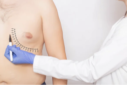 study-finds-that-men-with-excess-breast-tissue-at-higher-risk-of-early-death