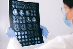 study-finds-that-human-brain-is-bigger-compared-to-75-years-ago-with-a-reserve-against-dementia